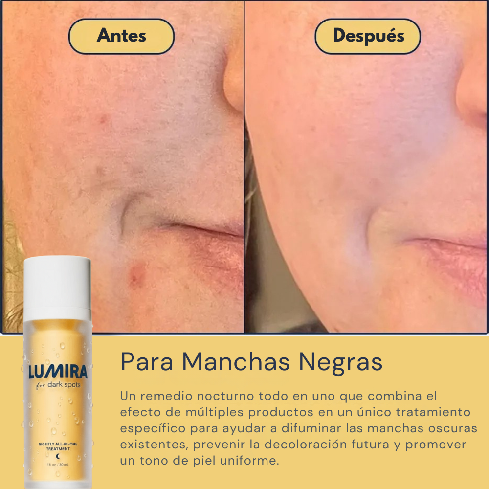 Lumira® Corrector de Manchas Oscuras